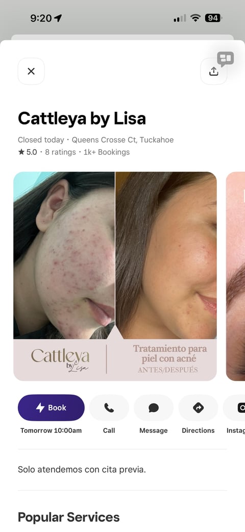 Cattleya by Lisa dermatology clinic profile showing before and after acne treatment photos with 5-star rating